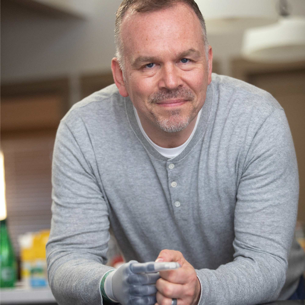 Jonathan Cowley utilisant une prothèse i-Limb